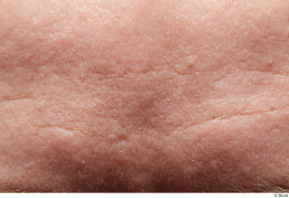 HD Face Skin Joe Dave forehead skin pores skin texture…